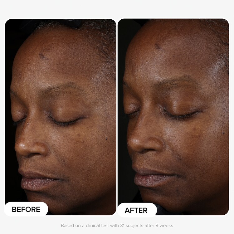 Boost - %10 Niasinamid Booster