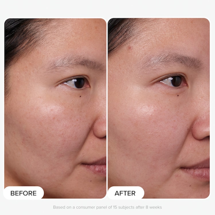 Clinical - Sérum 20 % Niacinamide