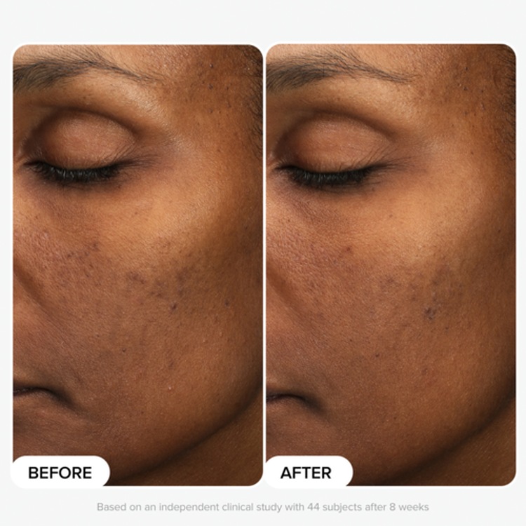 Multi-Level Exfoliation Trial Kit - Duo Découverte Exfoliants AHA + BHA