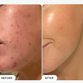 Skin Perfecting - Lotion Exfoliante 2 % BHA Holiday