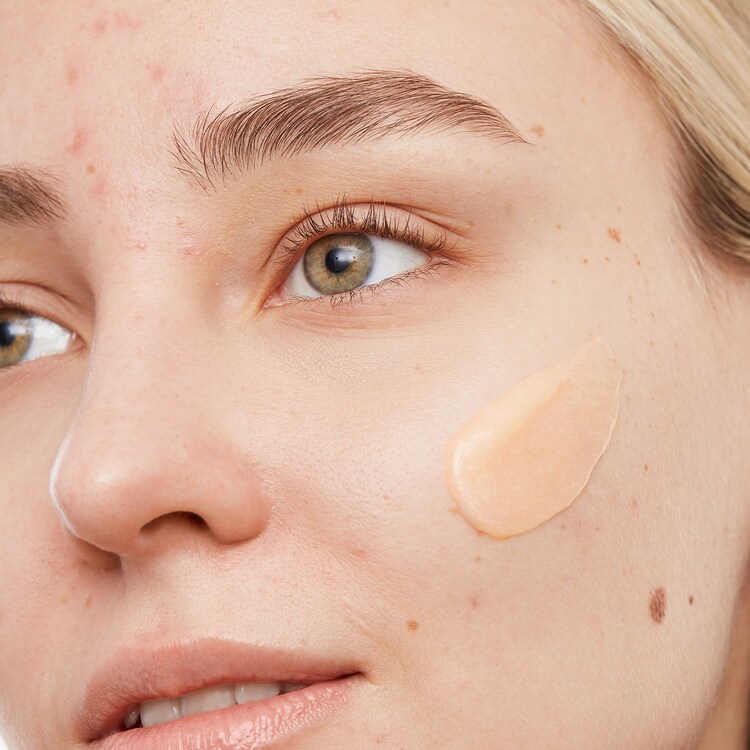 Gel detergente - Contro l'acne