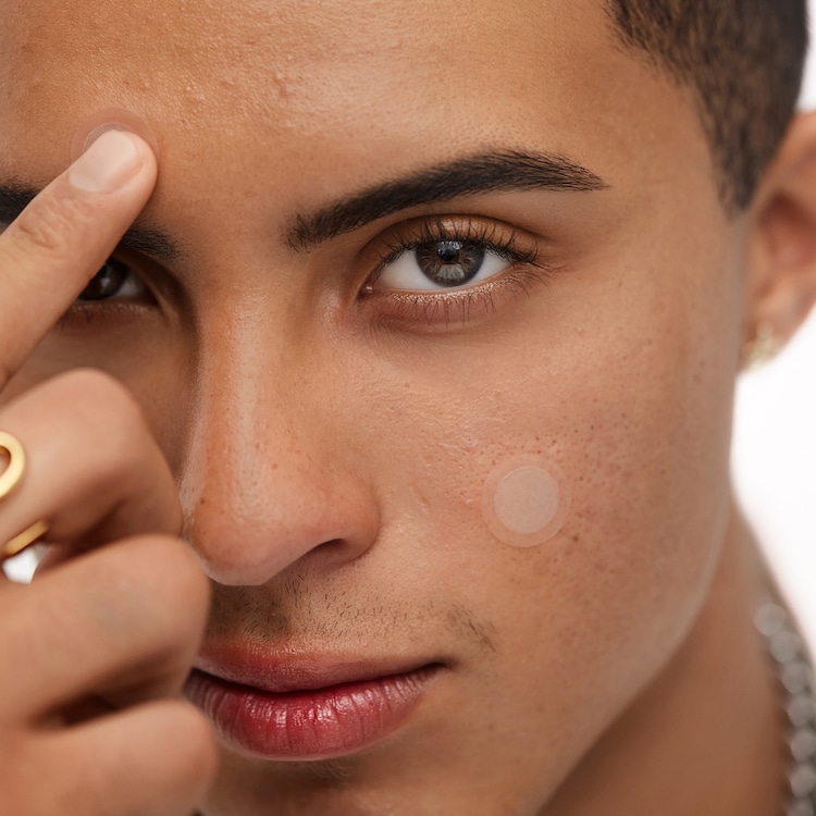 Plåster för behandling av akne - mikroperforering