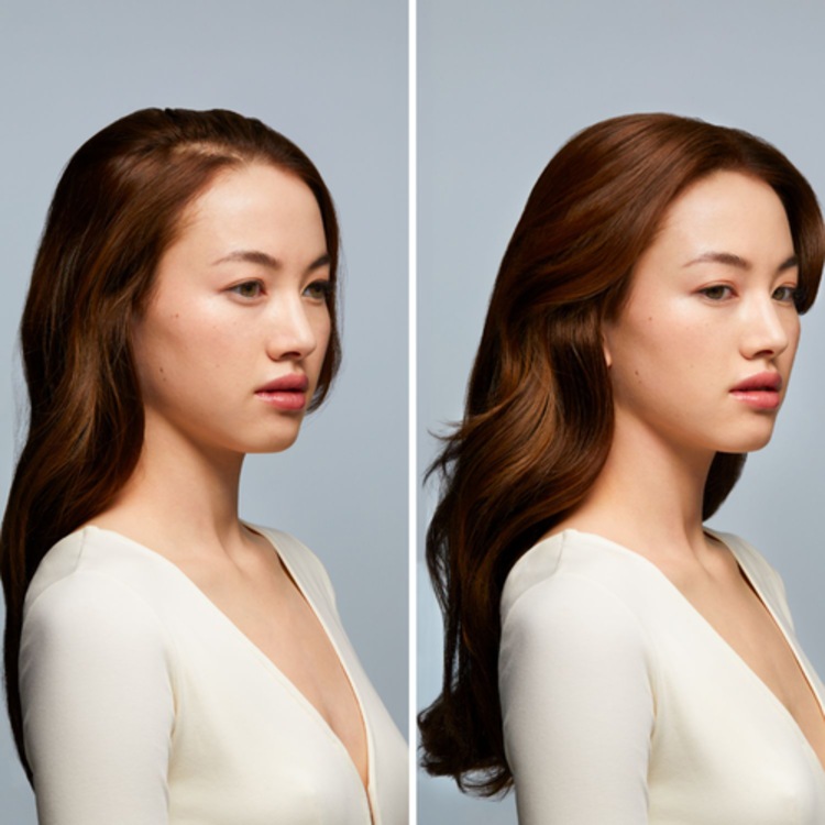 Triphasic - Traitement Antichute Progressive Solution Chute De Cheveux