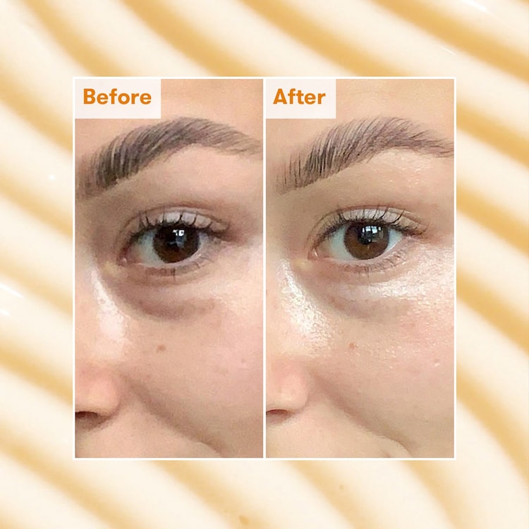 Radiance Brightening Dark Circle Eye Cream