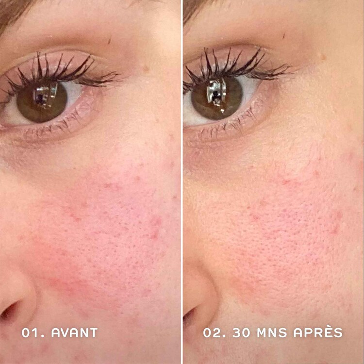 Evercalm™ - Sérum Apaisant Anti-Rougeurs