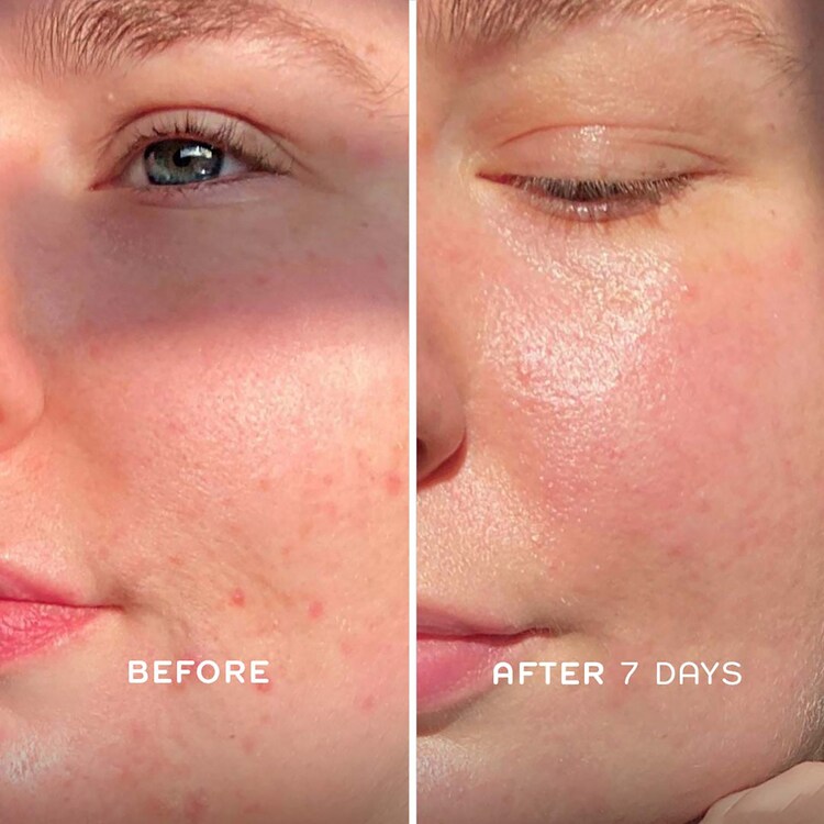 Evercalm™ - Huile pour le visage