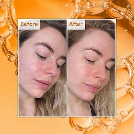 Radiance Ready Steady Glow - Daily AHA Tonic