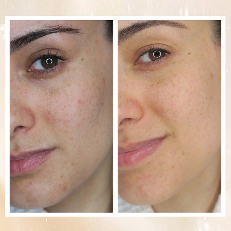 Radiance Overnight Glow Dark Spot Cream - Noční krém