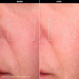 LET'S GET GLOWY SET &ndash; Mini sada rozjasňuj&iacute;c&iacute;ch př&iacute;pravků