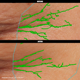 Lift & Firm - Crema occhi levigante e rassodante