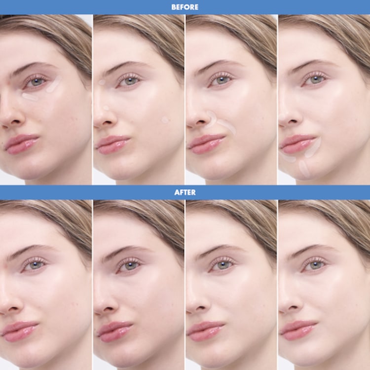 BEST SKIN EVER - Anticerne multi-usages