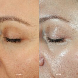 Jet Lag Overnight Eye Serum - Serum contour des yeux