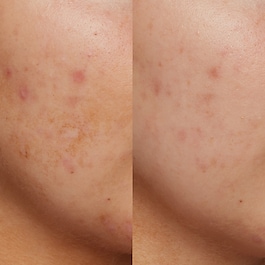 B3 Nice 10% Niacynamide - Serum rozświetlające