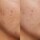 B3 Nice 10% Niacinamide - Siero luminosità