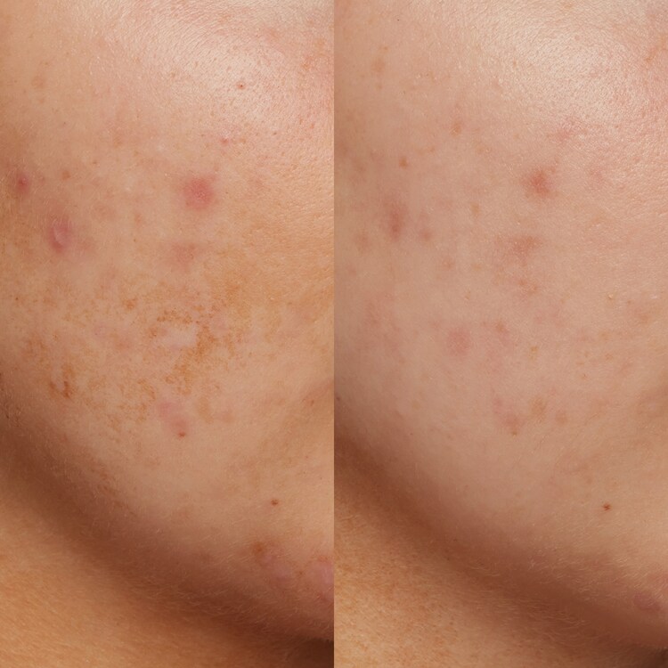 B3 Nice 10% Niacinamide - Siero luminosità