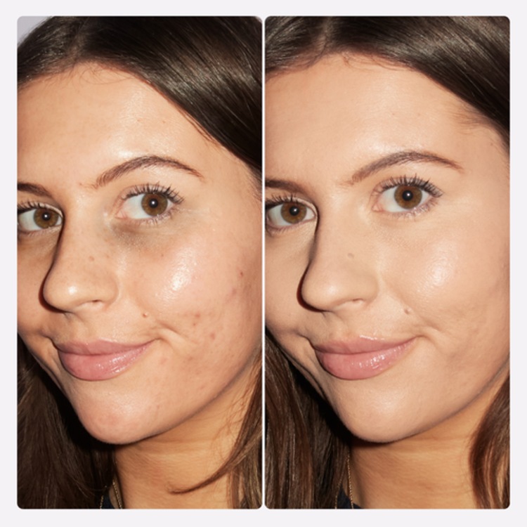 Shape tape™ – Stick anticernes effet floutant