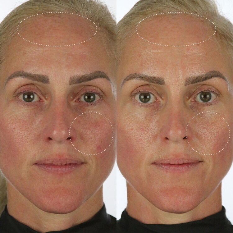 The Milky Sunscreen SPF50 - Αντηλιακή προστασία UV