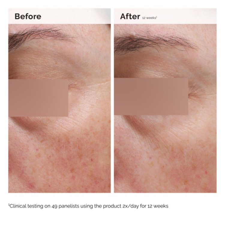 Émulsion Visage et Corps à la Niacinamide 5% - Emulsion légère