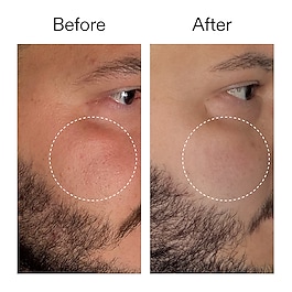 Starter Retinol Serum - S&eacute;rum R&eacute;tinol d'Initiation