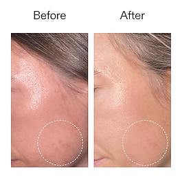 Advanced Retinal Serum - S&eacute;rum R&eacute;tinal Avanc&eacute;