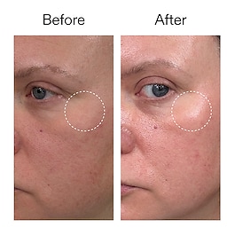 Advanced Retinal Serum - S&eacute;rum R&eacute;tinal Avanc&eacute;