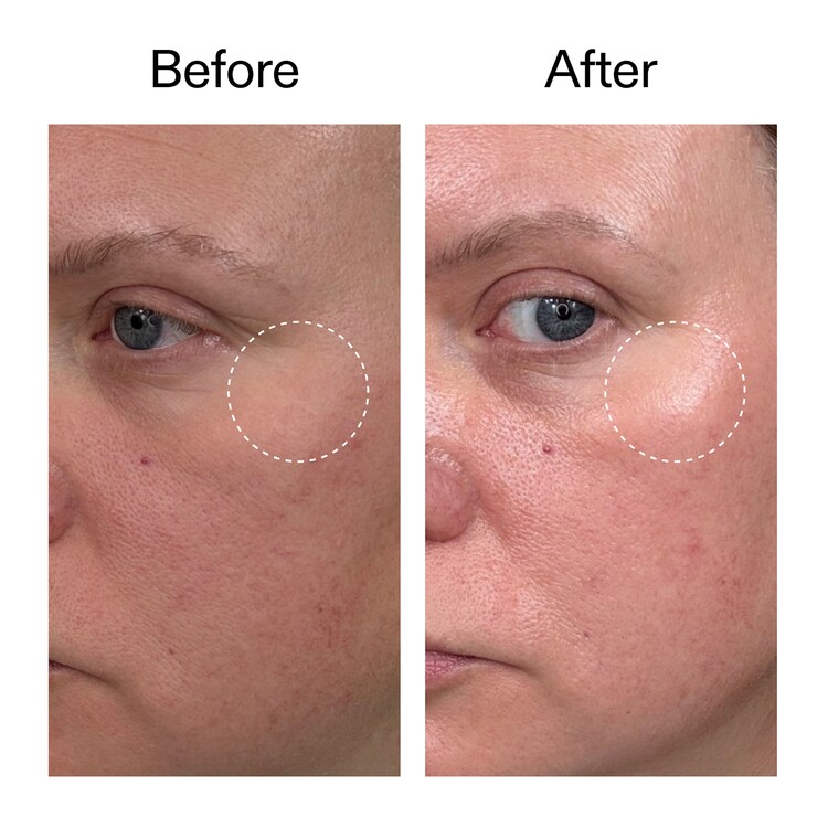 Advanced Retinal Serum - Siero al Retinale Avanzato