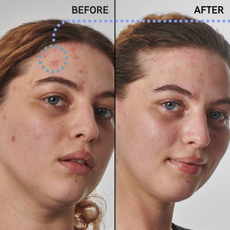 Solution pour la peau sèche et rugueuse avec de l'urée 10 % - Sérum visage