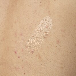 Siero corpo all'acido salicilico 0,5% - Siero anti-imperfezioni per il corpo