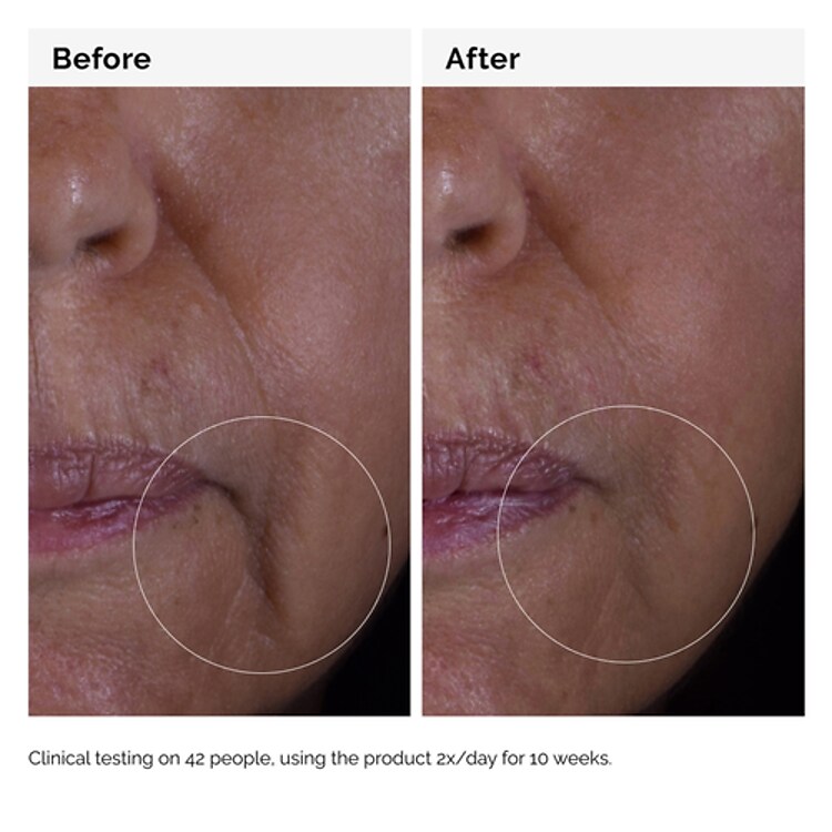 Solution GF 15% - Sérum anti-âge