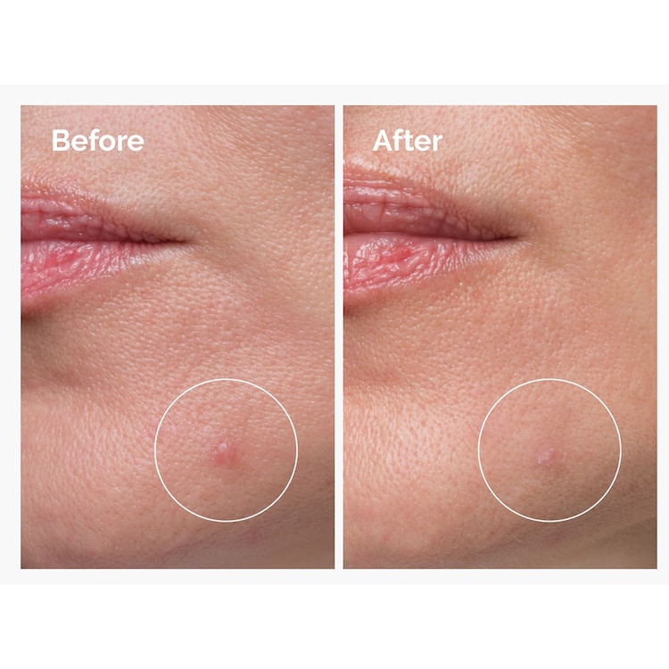 Concentrato Polvere-Crema con Zolfo 10% - Trattamento anti-imperfezioni