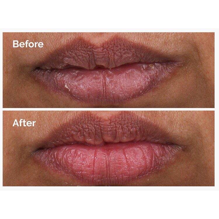 PHA 5% Exfoliating Lip Serum – Peeling Etkili Dudak Serumu