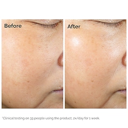 Rice Lipid Microemulsion + Ectoine - Microemulsione idratante