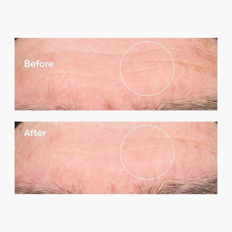 Acide Hyaluronique 2% + B5 - Sérum Hydratant