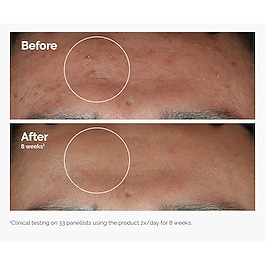 Niacinamide 10% + Zinc 1% - Siero Viso Anti-Imperfezioni