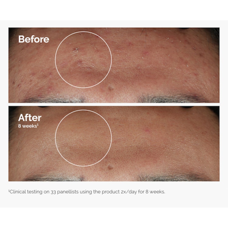 Niacinamide 10% + Zinc 1% - Sérum Anti-Imperfections