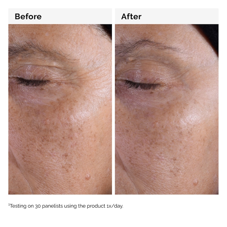 Solución tonificante con ácido glicólico 7 % - Loción exfoliante