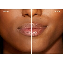 Lip injection Maximum Plump