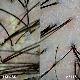 Scalp Remedy - Shampoo Virtue®