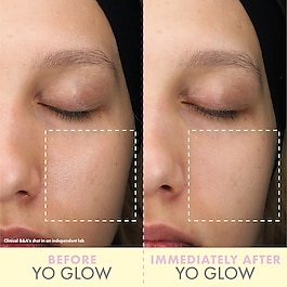 Yo Glow - Yüz peelingi 