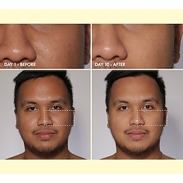 Yo Glow - Yüz peelingi 