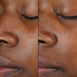 Kombucha + 11% AHA Exfoliation Power Toner