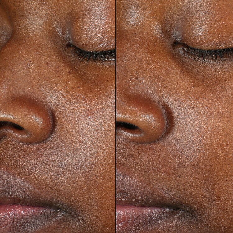 Kombucha - Exfoliation Power Toner