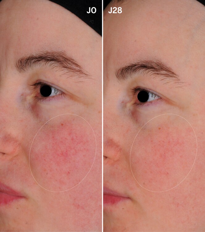 Rutyna regenerująca - Urządzenie LED i Kapsułki Skin Perfect