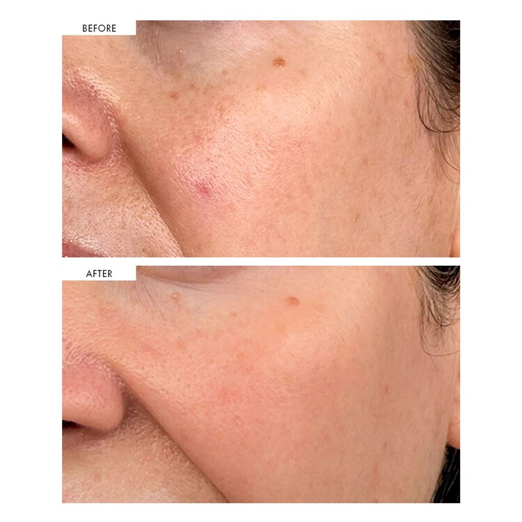 Dark Spot Correcting Serum - Siero Correttore Delle Macchie Scure