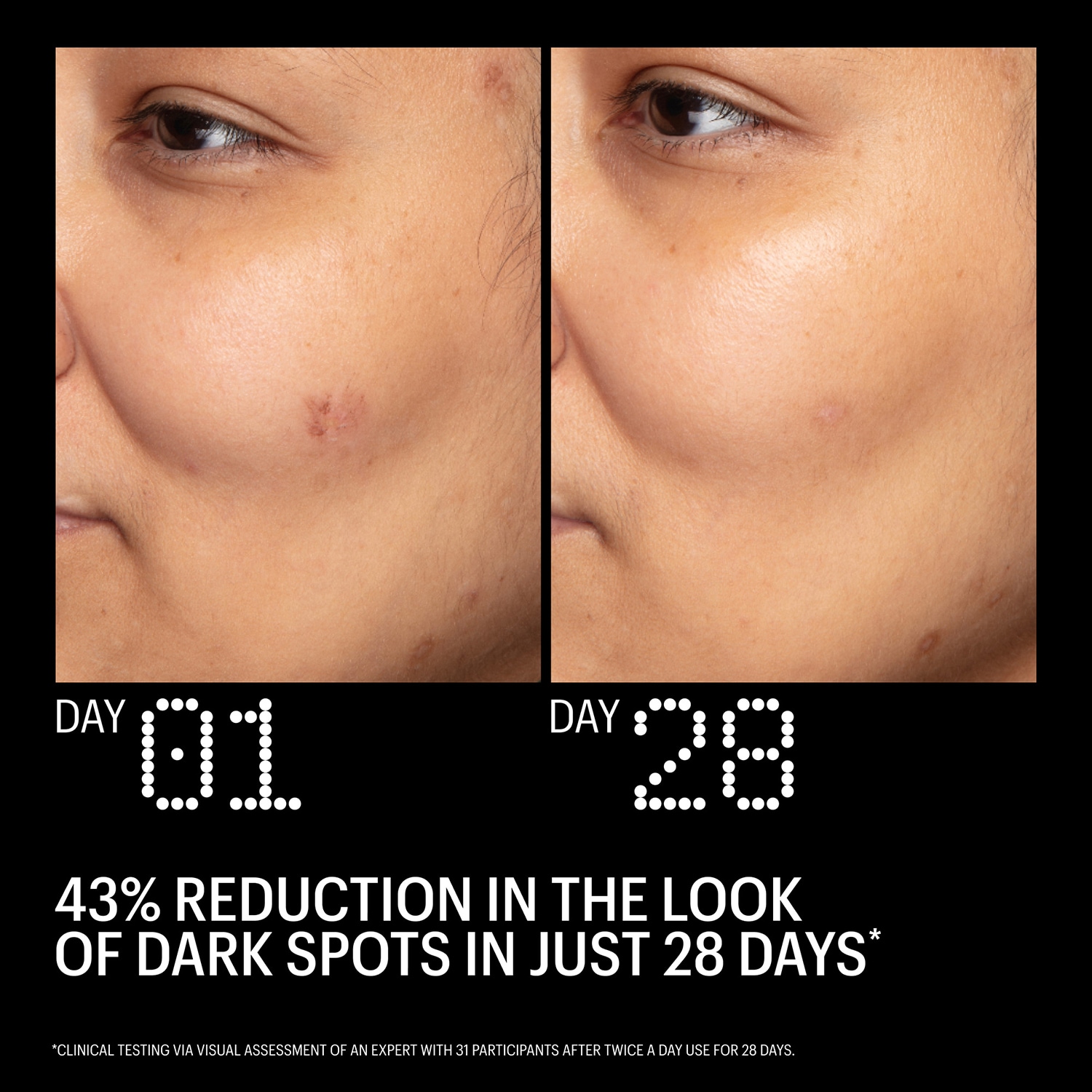 Azelaic & Kojic Advanced Clarifying Serum