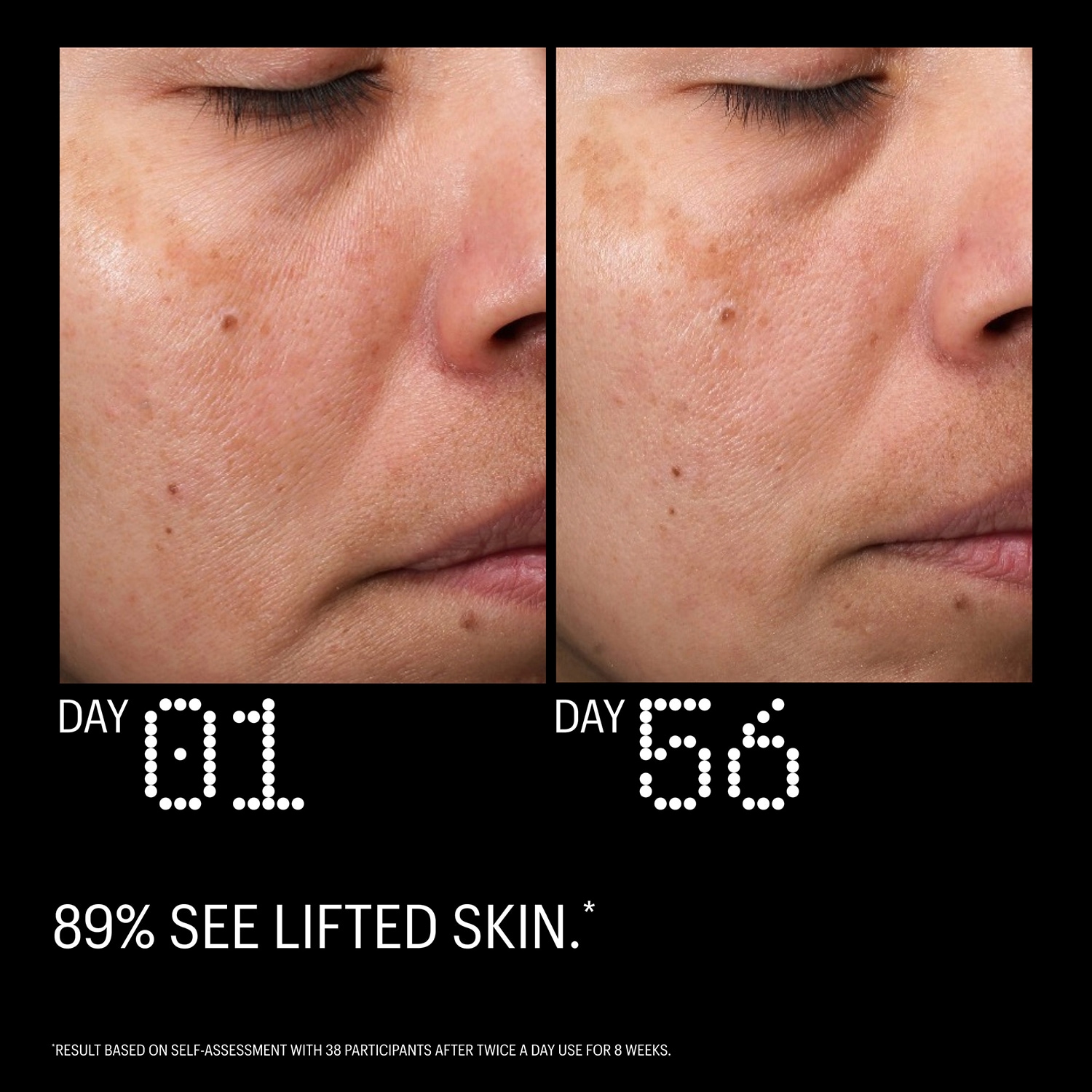 Multi Peptides & GF (Growth Factor) Advanced Lifting Serum