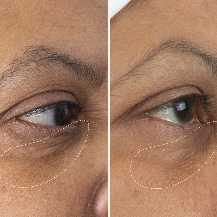 The Eye Cream Nomad