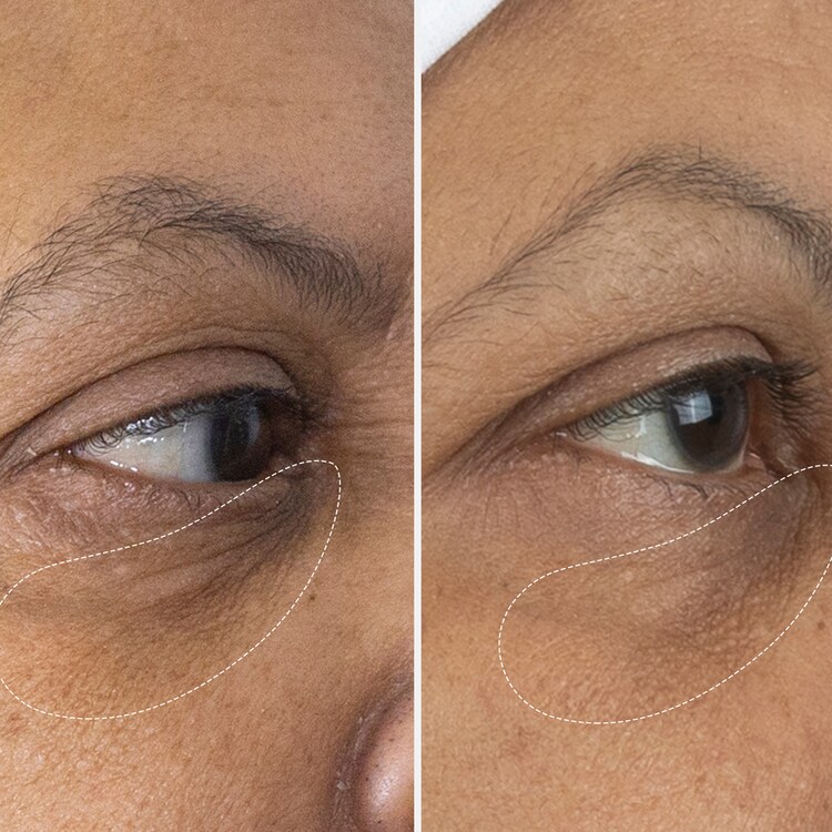 The Eye Cream