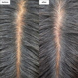 Scalp Revival Ugljen + Hlađenje s čajevcem - Maska za suho i iritirano vlasi&scaron;te