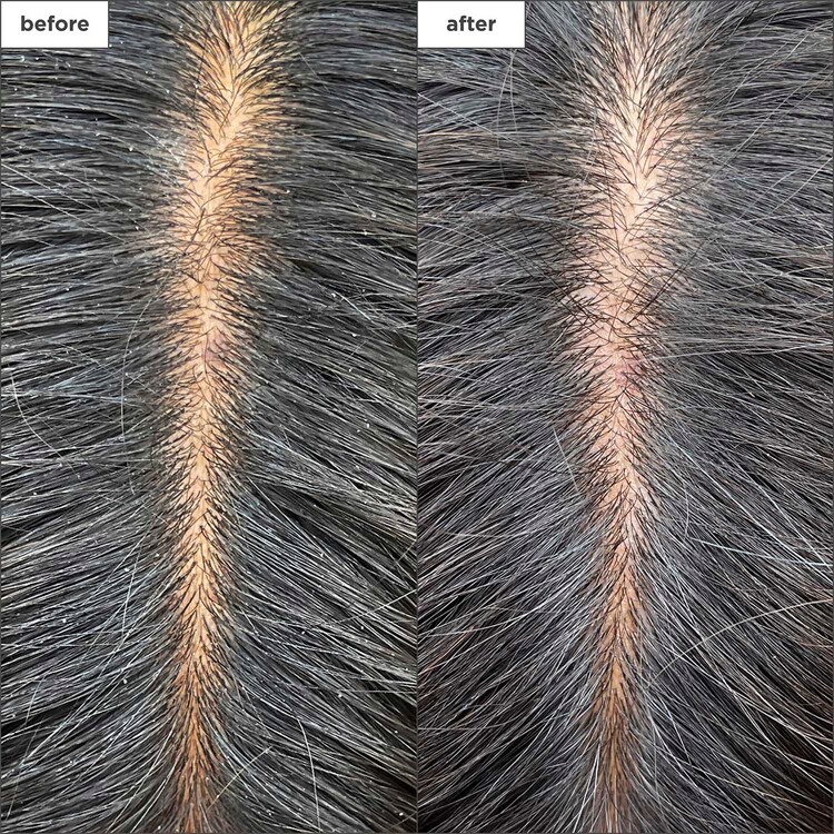 Scalp Revival